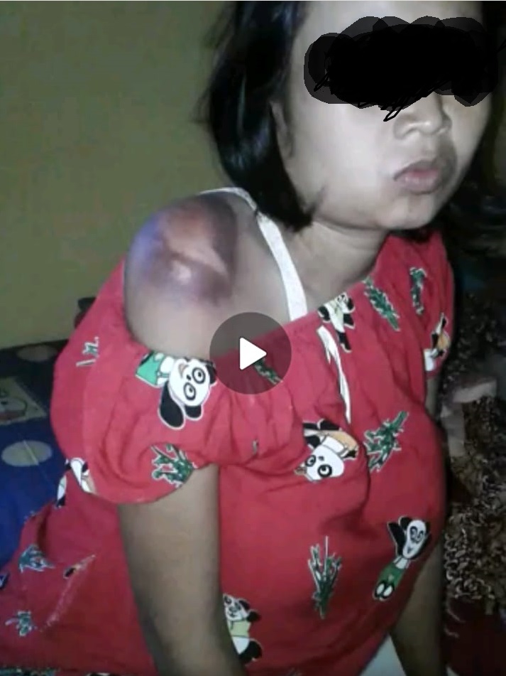 IRT Alami Pelecehan Seksual Hingga Hamil