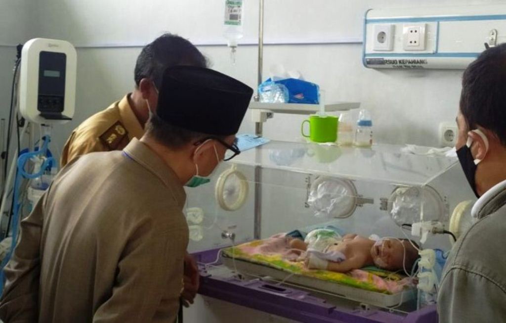 Bupati Hidayat Jenguk dan Bantu Bayi Penderita Hernia Diafragmatika