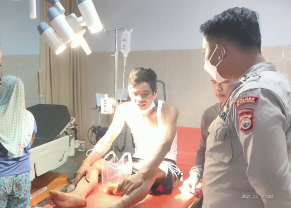 Gara-gara Hal Sepele Warga Curup Kena Bacok Paha