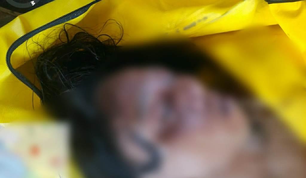 Polisi Selidiki Penemuan Mayat Perempuan dalam Kolam Renang Hotel