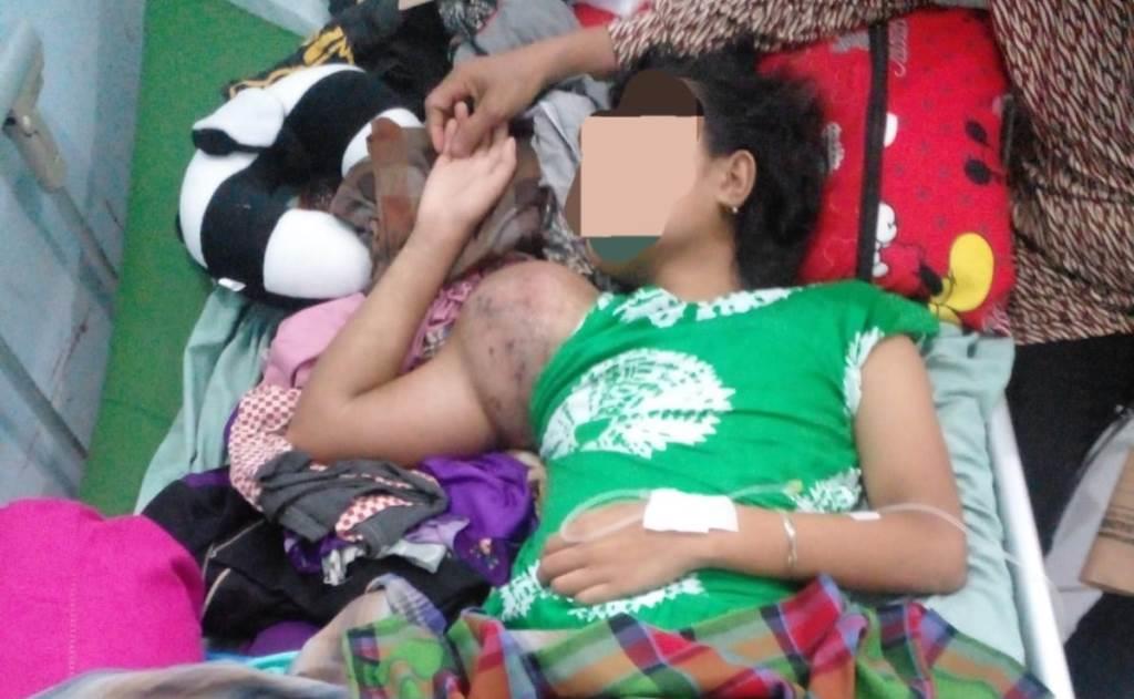 Idap Tumor Ganas, Remaja Asal Seluma Ini Butuh Uluran Tangan